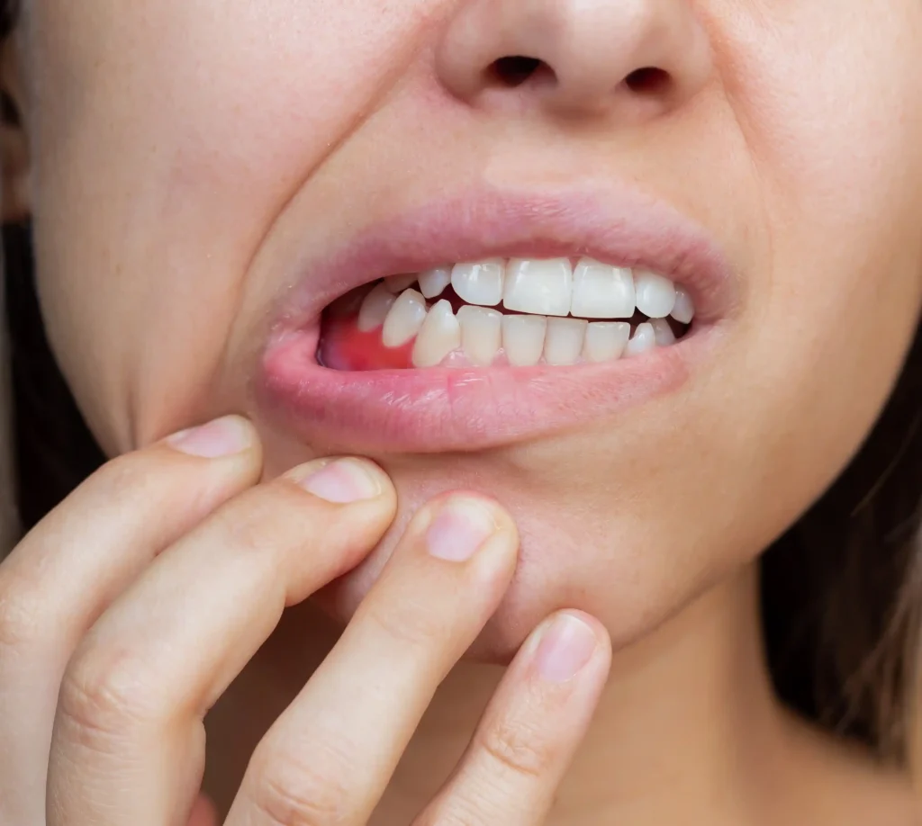 image of a women with gum disease at London, UK - Liberty Dentists